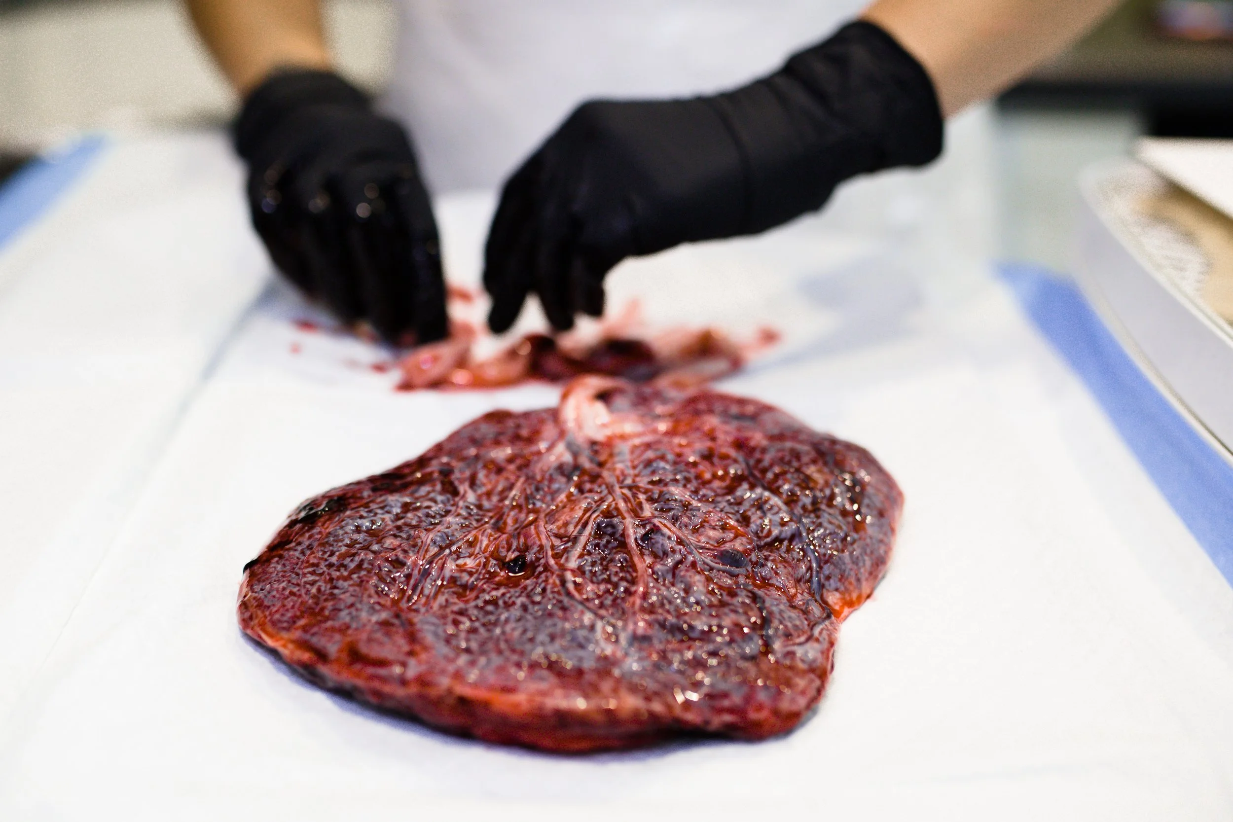 The Placenta Girl